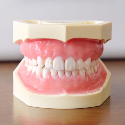 歯科技工　有床義歯 1629216_m-500x500.jpg
