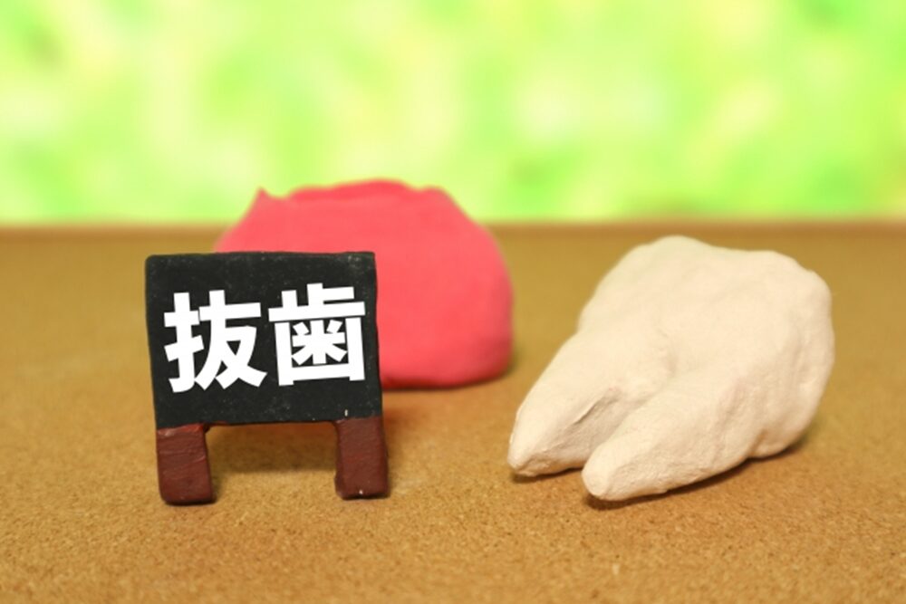 親知らずの抜歯について
