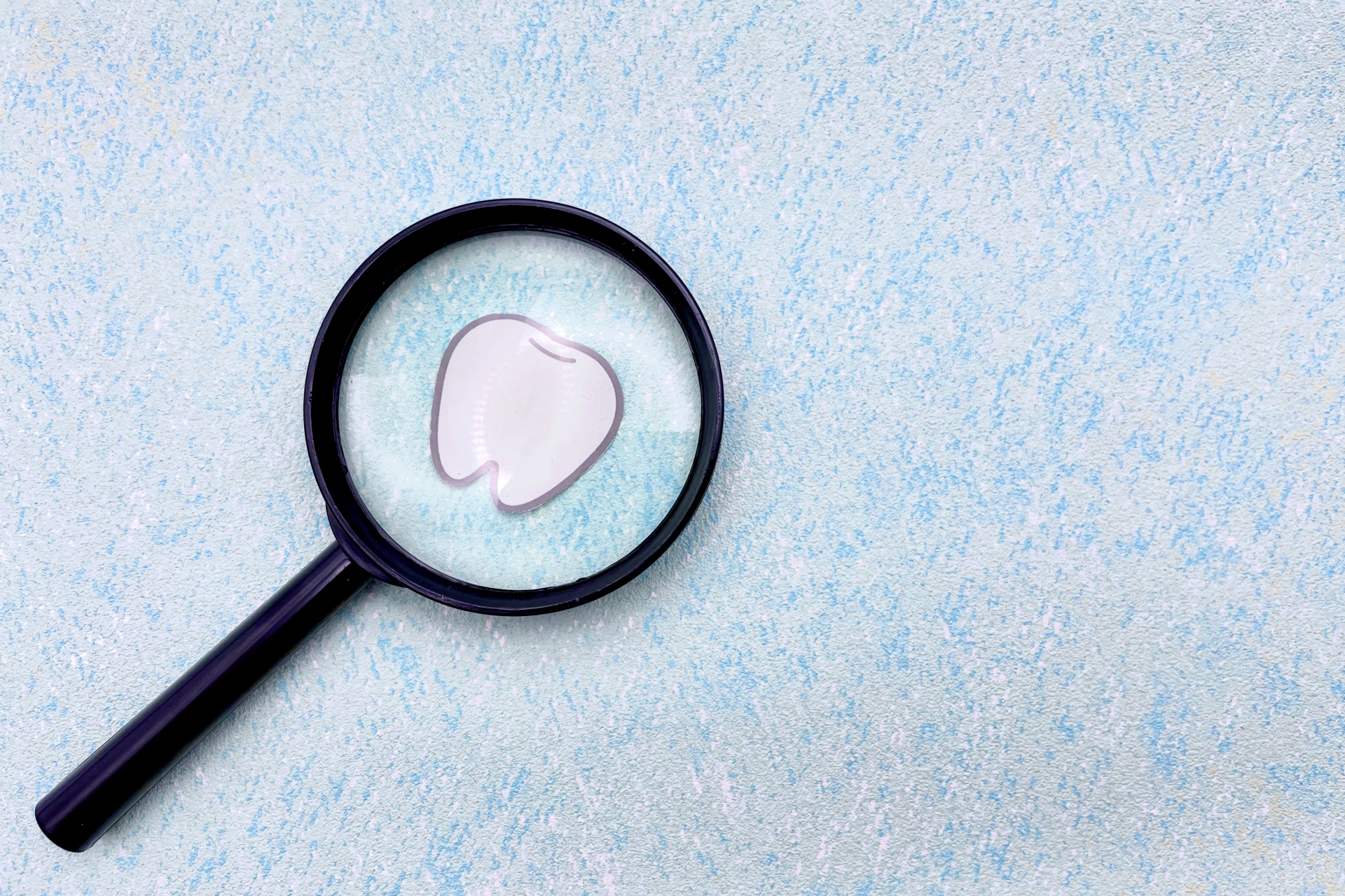 むし歯のセルフチェック方法