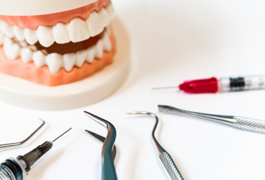 歯医者さんの麻酔は痛い？麻酔の種類や痛みを軽減する方法も解説