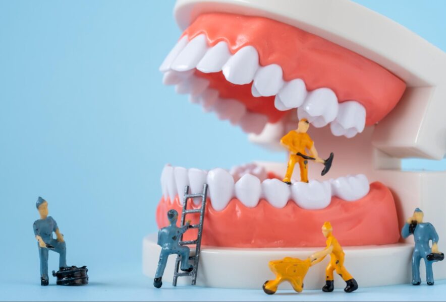 入れ歯の作り方｜作製の流れや完成までの期間の目安、メンテナンスも解説