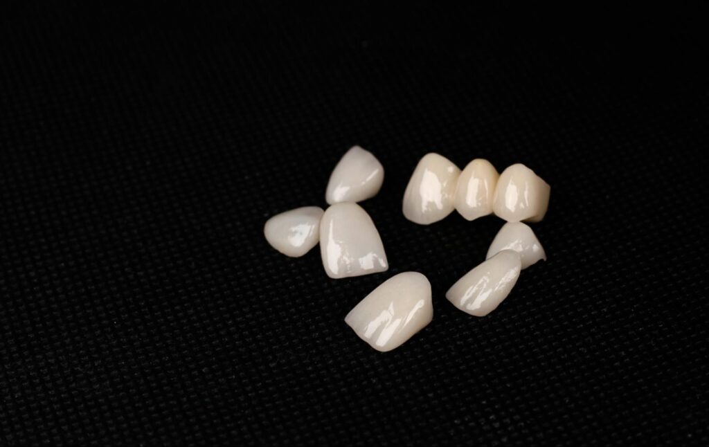 セラミッククラウンとハイブリッドセラミッククラウンの特徴